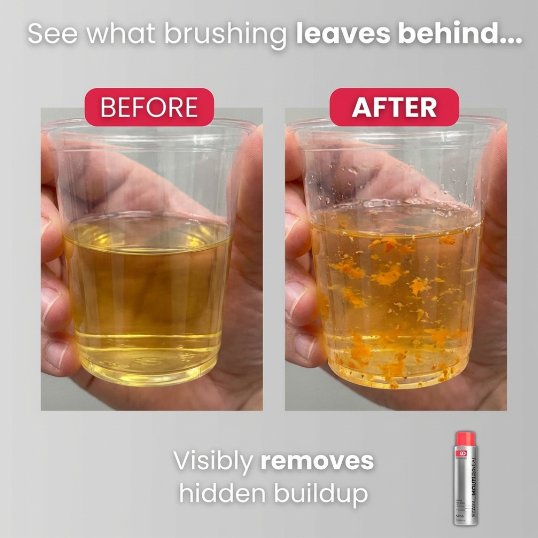 ID Kalya BrightReveal™ Cosmetic Mouthwash