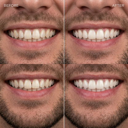 ID Kalya BrightReveal™ Cosmetic Mouthwash