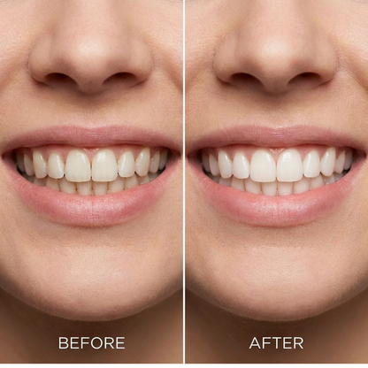 ID Kalya BrightReveal™ Cosmetic Mouthwash